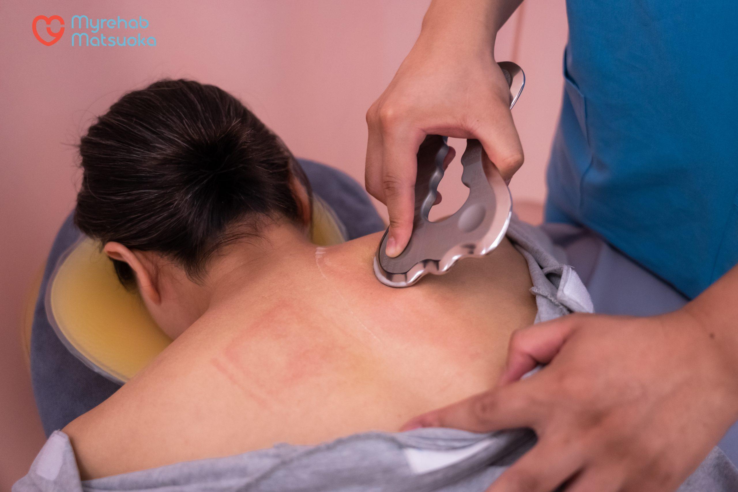 Kỹ thuật viên thực hiện kỹ thuật Circling kết hợp chườm đá nóng, giúp giải phóng cơn đau vai gáy cho người làm việc đêm