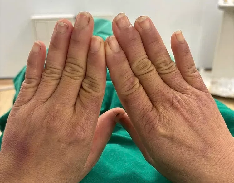 Bàn tay nhẹ nhàng đặt tinh dầu lên lưng dưới của nữ khách hàng trong phòng tối