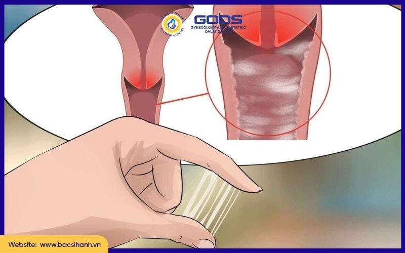 Minh họa các bước vệ sinh vùng kín an toàn cho mẹ bầu